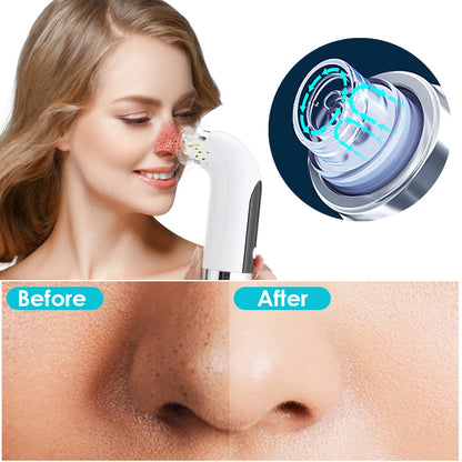 Blackhead Remover Pore Cleaner Vacuum Suction Acne Remover Pimple Black Dot Removal Facial Cleaning Beauty Tools Face Skin Care - naiveniche